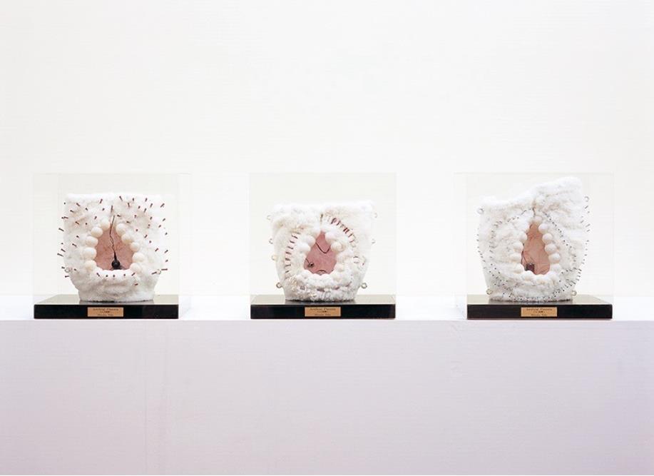 田部光子《人工胎盤》1961年(2004年再制作)　熊本市現代美術館蔵
