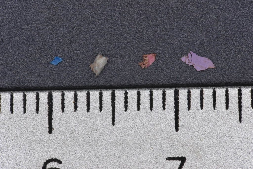 クジラの体内から見つかったマイクロプラスチック　写真提供：国立科学博物館
