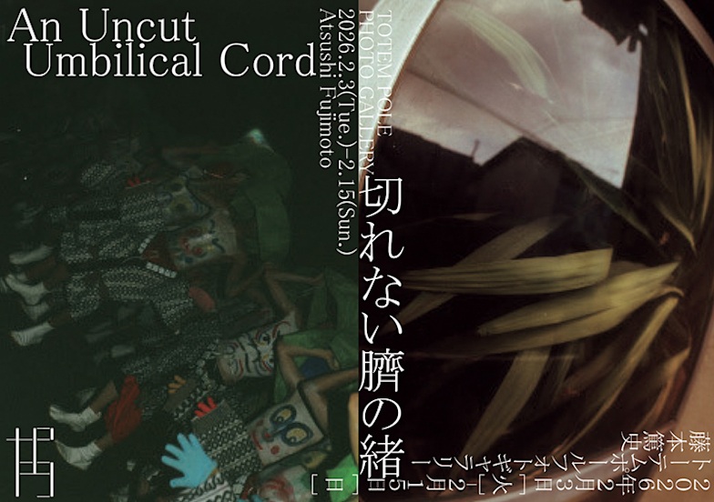 藤本篤史「切れない臍の緒」Totem Pole Photo Gallery